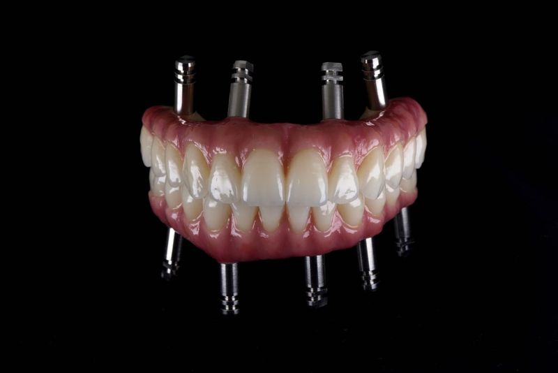 visi dantys ant 4; all-on-4