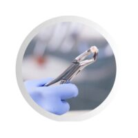 Dantų šalinimas – nuotolinė konsultacija