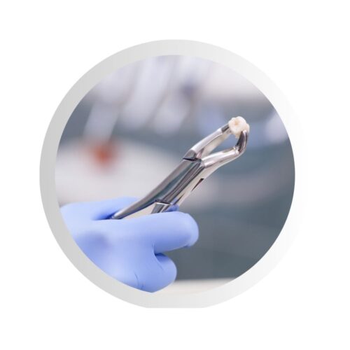 Dantų šalinimas – nuotolinė konsultacija