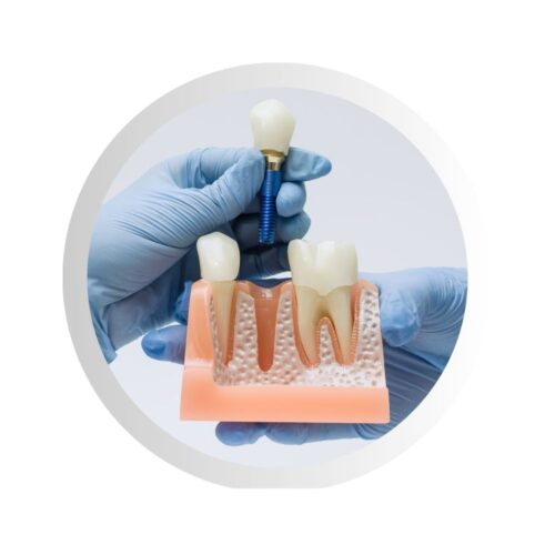 Dantų implantacija – nuotolinė konsultacija