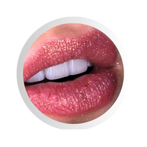 Laminatės – nuotolinė konsultacija