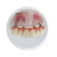 All-on-4 – nuotolinė konsultacija dėl implantacijos