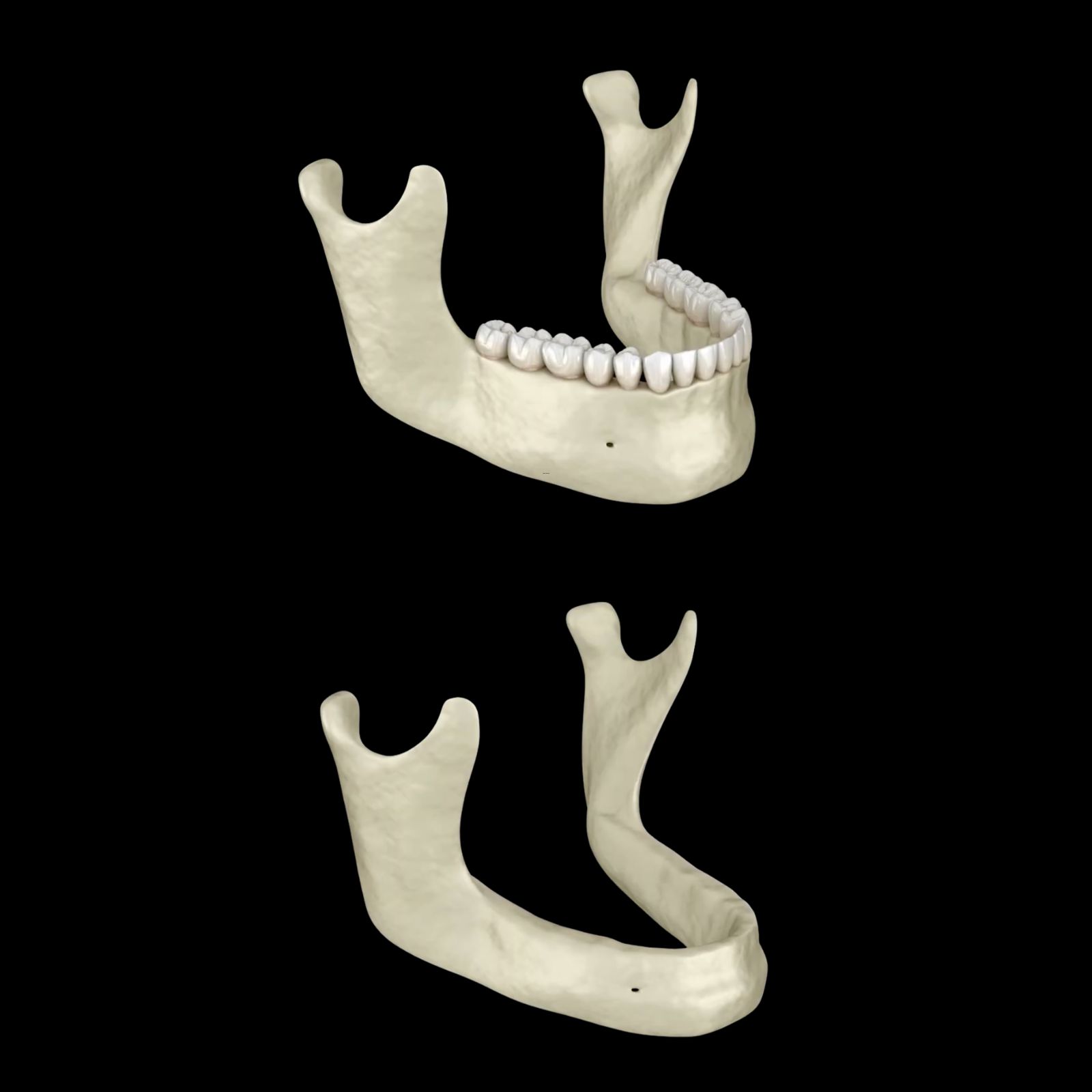 Žandikaulio rentgenas